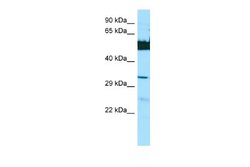 LGSN Rabbit anti-Human, Polyclonal, Novus Biologicals 0.1 mL | Buy Online | Novus Biologicals | Fisher Scientific